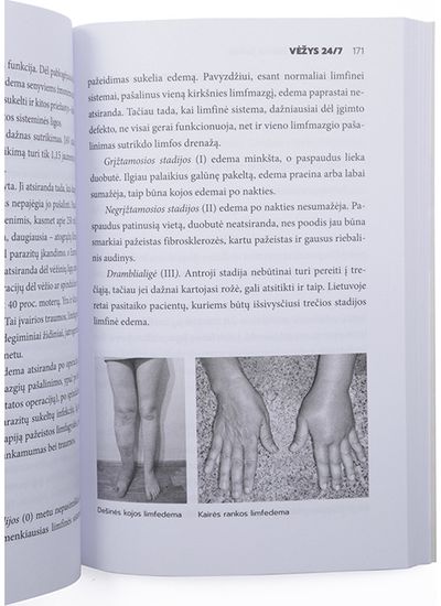 Virginijus Šaulys - Vėžys. 24/7 - 000000000001112337