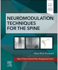 Neuromodulation Techniques for the Spine A Volume in the
