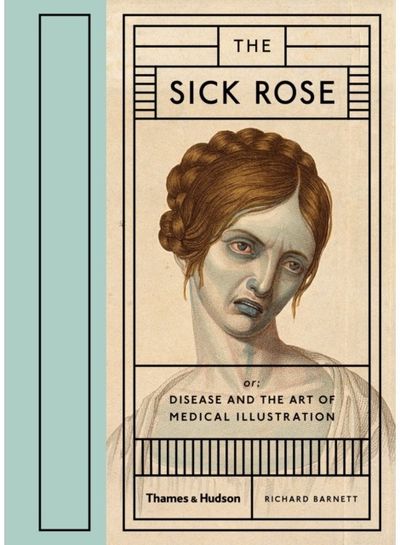 Sick Rose Or; Disease and the