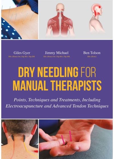 Dry Needling for Points, Techniques