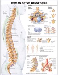 Human Spine Disorders Anatomical Chart