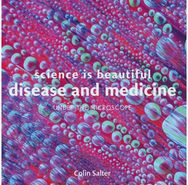 Science is Beautiful: Disease and Medicine: Under the Microscope Under the Microscope