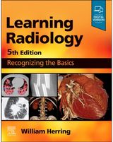 Learning Radiology Recognizing the
