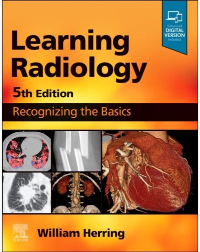 Learning Radiology Recognizing the