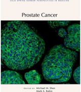 Prostate Cancer