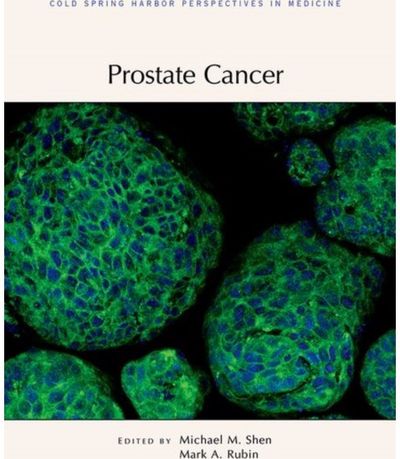 Prostate Cancer