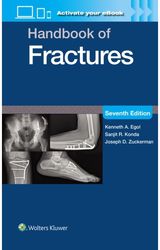 Handbook of Fractures: Print + eBook with Multimedia