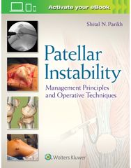 Patellar Instability: Management Principles and Operative Techniques Management Principles and Operative Techniques