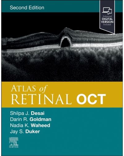 Atlas of Retinal OCT Optical Coherence