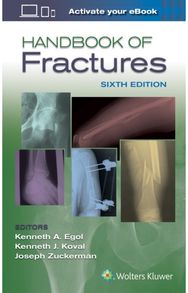 Handbook of Fractures