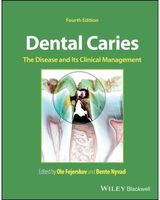 Dental Caries The Disease and its