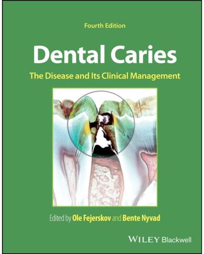 Dental Caries The Disease and its