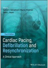 Cardiac Pacing, A Clinical Approach