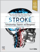 Stroke Pathophysiology,