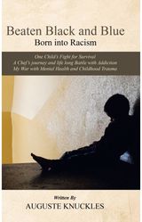 Beaten Black and Born into Racism