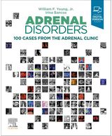 Adrenal Disorders 100 Cases from the