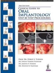Clinical Guide to Oral Implantology: Step by Step Procedures