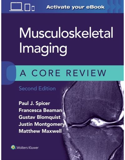 Musculoskeletal Imaging: A Core Review