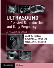 Ultrasound in Assisted Reproduction and Early Pregnancy: A Practical Guide