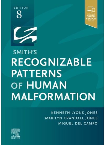 Smiths Recognizable Patterns of Human Malformation
