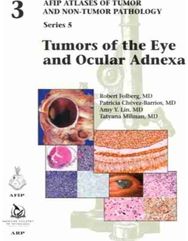 Tumors of the Eye and Ocular Adnexa