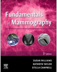 Fundamentals of Mammography