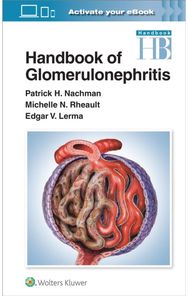 Handbook of Glomerulonephritis
