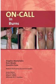 On-Call in Burns