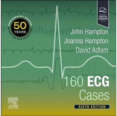 160 ECG Cases