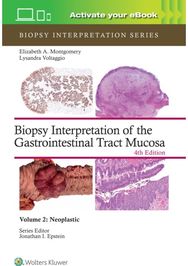 Biopsy Interpretation of the Gastrointestinal Tract Mucosa Volume 2: Neoplastic: Print + eBook with Multimedia