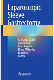 Laparoscopic Sleeve Gastrectomy