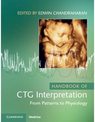 Handbook of CTG Interpretation: From Patterns to Physiology