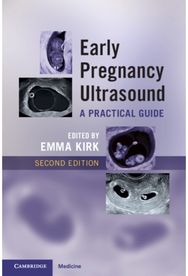 Early Pregnancy Ultrasound: A Practical Guide