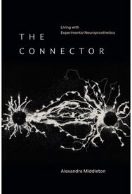 Connector: Living with Experimental Neuroprosthetics