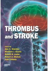 Thrombus and Stroke