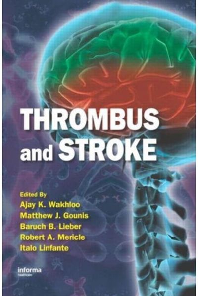 Thrombus and Stroke