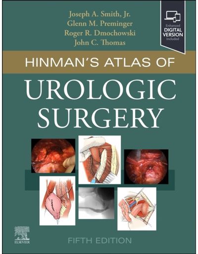 Hinmans Atlas of Urologic Surgery