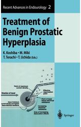 Treatment of Benign Prostatic Hyperplasia