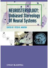 Neurostereology: Unbiased Stereology of Neural Systems