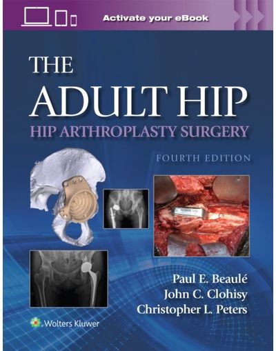 Adult Hip: Hip Arthroplasty Surgery Print + eBook with Multimedia