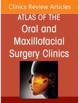 Implant Solutions for Complex Cases: Graftless Solutions, An Issue of Atlas of the Oral & Maxillofacial Surgery Clinics