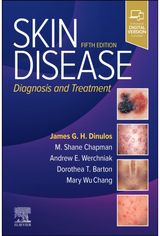 Skin Disease: Diagnosis and Treatment