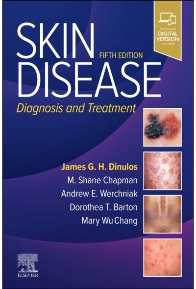 Skin Disease: Diagnosis and Treatment
