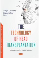 Technology of Head Transplantation